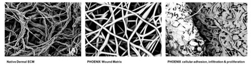 Native-Dermal-Phoenix-Wound-Matrix-Cellular